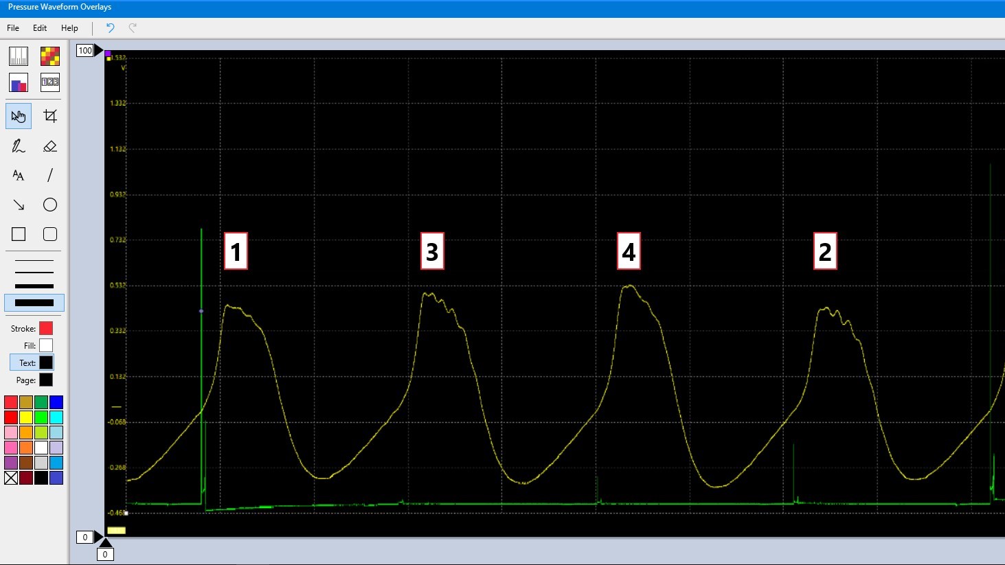 preview of pressure waveform overlays app